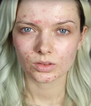 Maquillaje para tapar acné My Pale Skin
