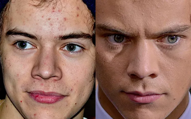 harry styles acne