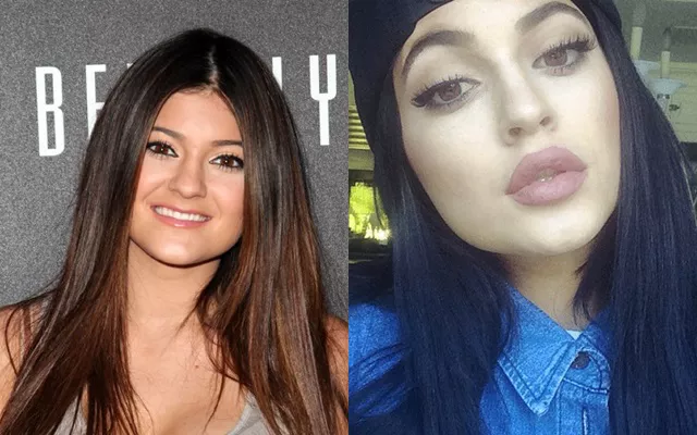 labios de kylie jenner