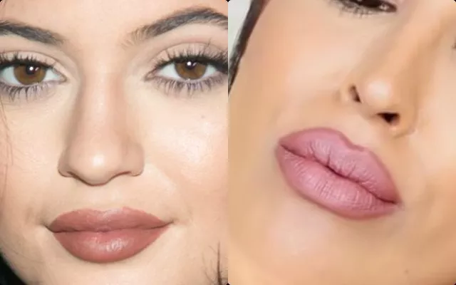 labios de kylie jenner