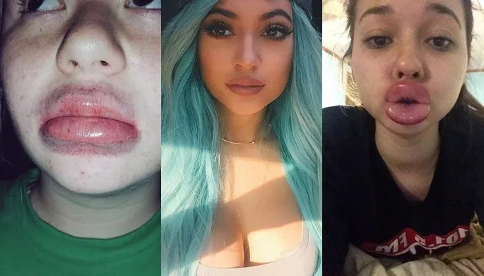 #KylieJennerChallenge