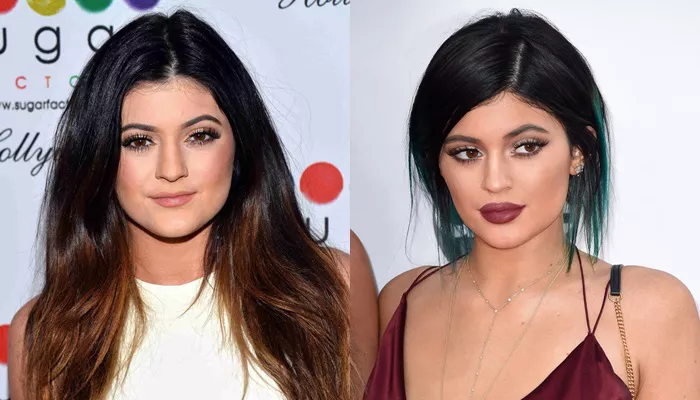 labios kylie jenner