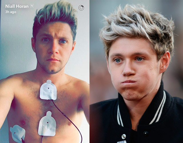 El selfie de Niall Horan en el hospital alarma a sus fans