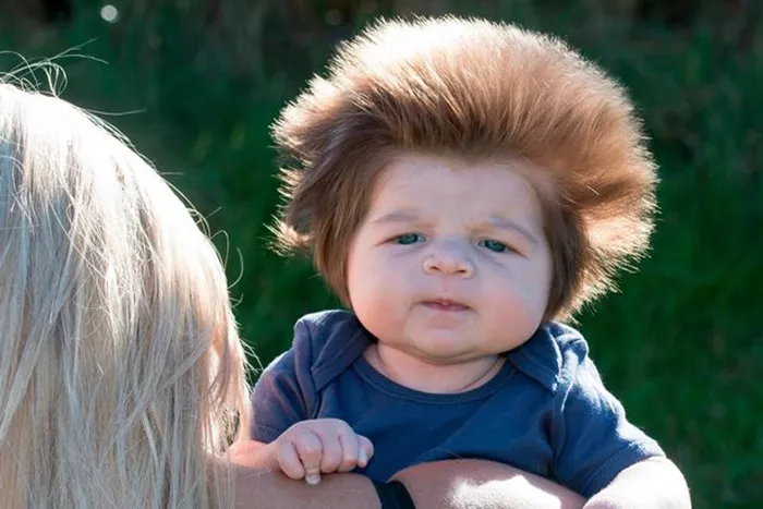 bebe mucho pelo