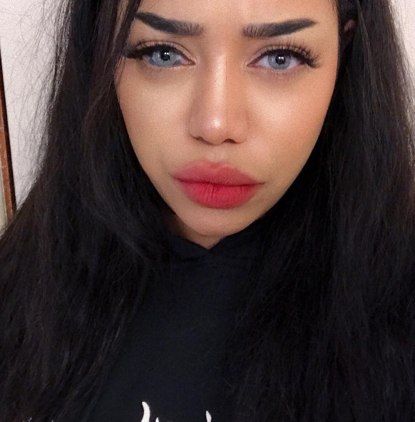 Esta instagramer ha pedido a sus seguidores que dejen de preguntar por su ojo
