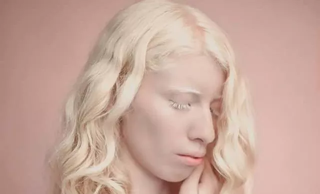 modelo albina 