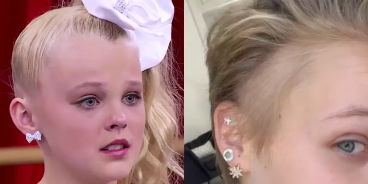 JoJo Siwa revela que una calva en un lado de su cabeza fue causada por un sarpullido por estrés cuando estaba en 'Dance Moms', y no por su característica cola de caballo