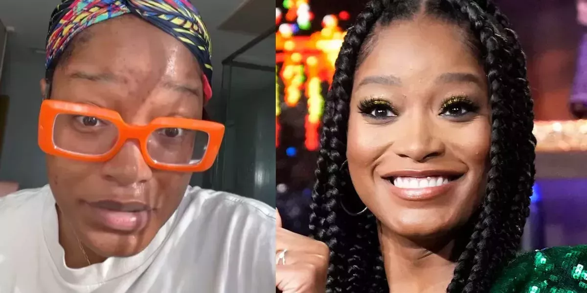 Keke Palmer se sincera con sus fans sobre su acné adulto en un vídeo de Instagram y pide a los cirujanos plásticos que encuentren una cura