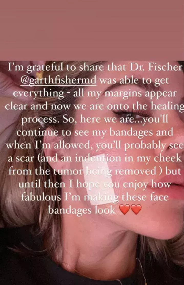 Khloé Kardashian se extirpa un tumor de la cara