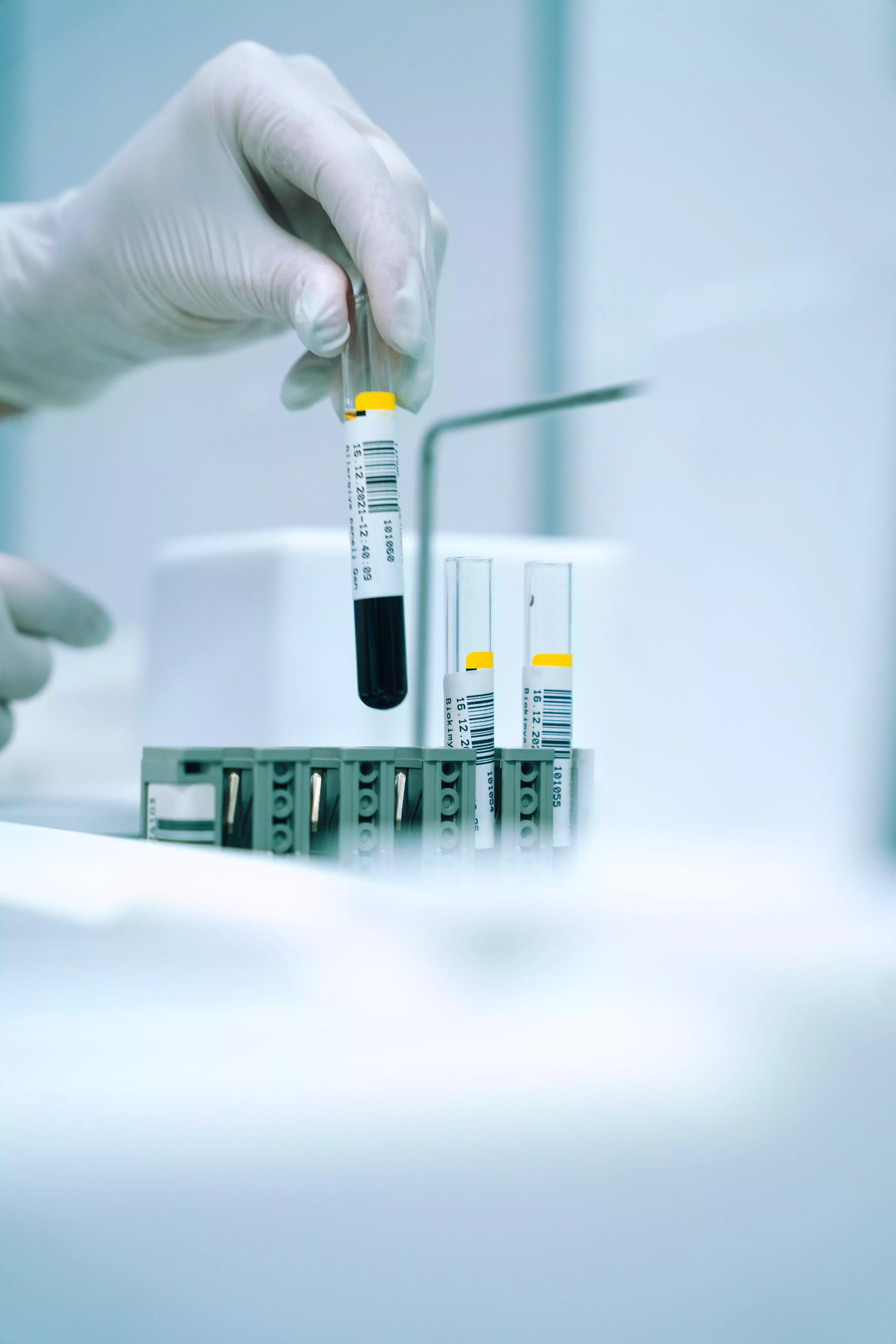 Biopsia líquida: una revolución en la detección del cáncer