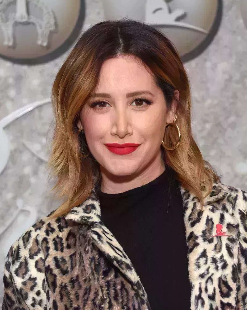 Confesiones de famosos sobre cirugía plástica: Ashley Tisdale, Dixie D'Amelio, Más